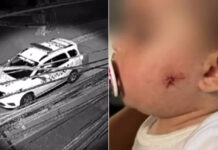 PM atira em rosto de menina de 1 ano com arma de airsoft na Zona Leste de SP