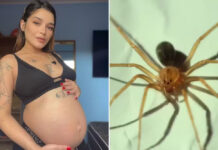 Grávida tem pele da perna necrosada após ser ‘picada’ por aranha venenosa: ‘não conseguia andar’