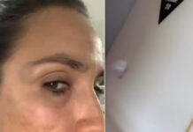 Mulher leva socos de professor de surfe após discussão no mar e usa prancha para se proteger de martelada