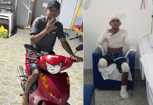 Adolescente tem braços, perna e parte de pé amputados após levar choque de alta voltagem