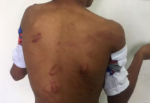 Baixada Santista tem alta nos casos de lesão corporal dolosa