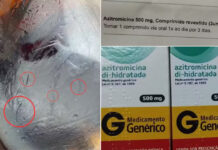 Família bebe refrigerante com pelos e médicos receitam remédio para leptospirose