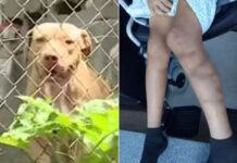 Cadela é morta e menino de 12 anos hospitalizado após ataque de pit bulls